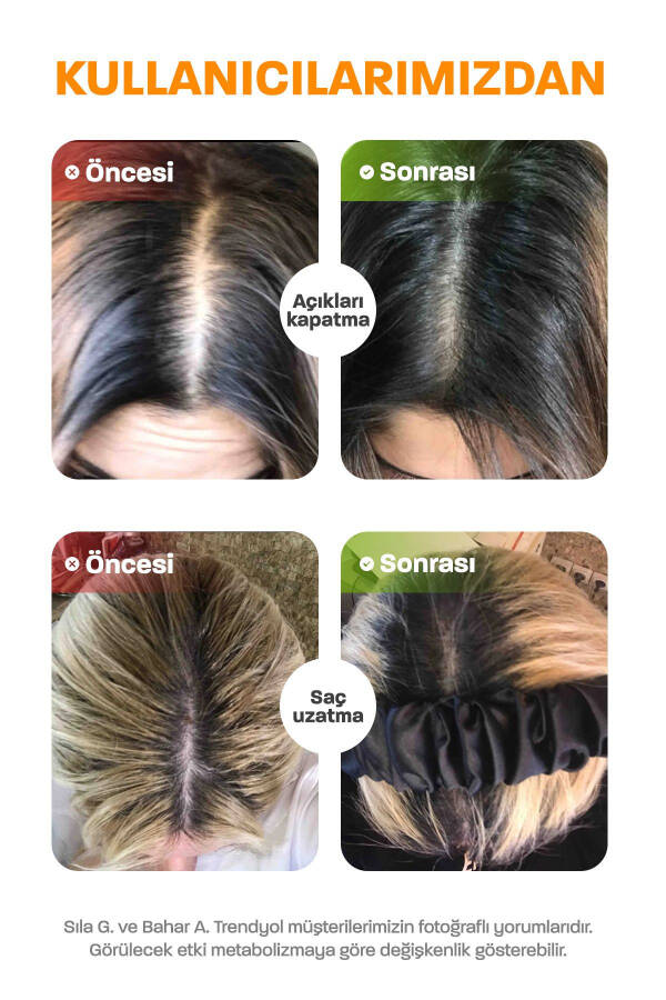 Saç ve Tırnak Vitamini - Hair Vitamin B Kompleksi - Biyotin Tablet Keratin Selenyum Çinko Saç Dökülmesi - 6